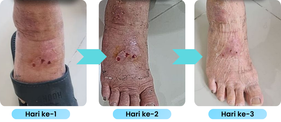 Testimoni Sugianto Halim